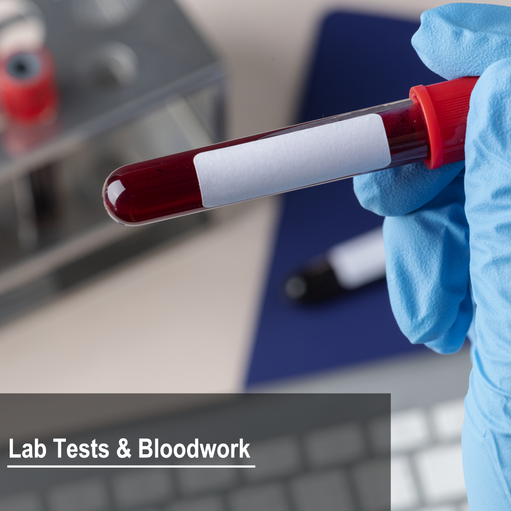 laromainefamilymedical-labtests